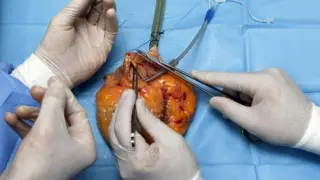 Conseguir fabricar corazones bioartificiales humanos es el objetivo del Hospital Gregorio Marañón