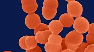 Staphilococcus epidermidis, una bacteria generalmente inofensiva que se encuentra en casi todas las zonas de nuestra piel