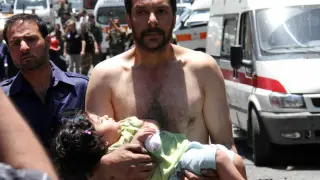 Un hombre lleva en brazos a una niña herida