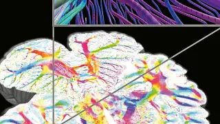 Zoom de una reconstrucción en 3D de un cerebro humano a partir de imágenes de luz polarizada
