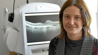 Elena García, junto a una de las máquinas que permiten observar el nervio óptico, en el Miguel Servet