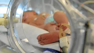 Un bebé prematuro, durante su desarrollo en la incubadora
