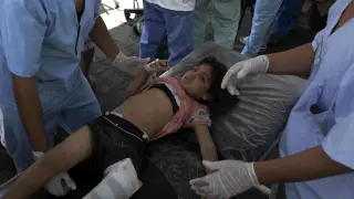Una niña herida es atendida en un hospital de Gaza