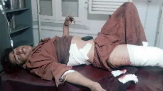 Una víctima del atentado, en un hospital de Paktika