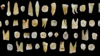 Los dientes encontrado en China.