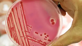 Bacteria de la salmonela en una placa de petri