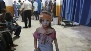 Imagen de una niña siria atendida en un hospital de Damasco (de la serie ganadora del World Press Photo).