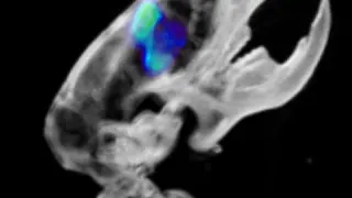 Una imagen del ratón utilizado para el famoso PET (tomografía de emisión de positrones).