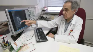 El jefe de Cirugía del hospital Obispo Polanco, José María del Val, muestra un estudio mamario.