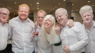 Imagen del primer encuentro nacional de jóvenes albinos, en 2016