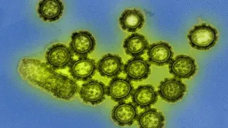 Micrografía electrónica coloreada que muestra partículas del virus de la gripe H1N1. Las proteínas superficiales del mismo están destacadas en negro