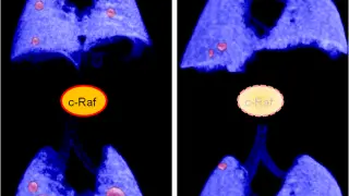 La eliminación de c-Raf induce la regresión de los tumores de pulmón avanzados en modelos de ratón.