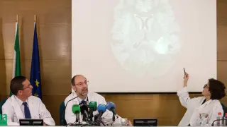 Doctores de neurocirugía de Málaga explican en rueda de prensa el caso del joven.