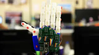 La mano robótica de Teo hace movimientos similares a los que podría realizar una mano humana