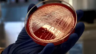 Cultivo de listeria en una placa de Petri, en el Laboratorio de Listeriosis del Centro Nacional de Microbiología.