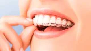 La ortodoncia es mucho más que conseguir una sonrisa estética.