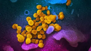 Virus SARS-CoV-2 (en amarillo) emergiendo de células (rosadas y azules) cultivadas en el laboratorio. Imagen vista con el microscopio electrónico de barrido y virus aislados de un paciente en EE. UU.