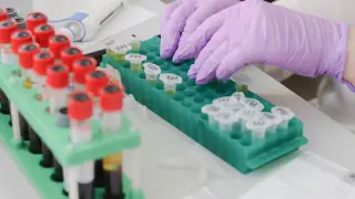 Procesado de muestras biológicas para el análisis por PCR.