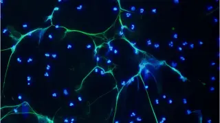 Neutrófilos activados (azul) lanzan redes de cromatina (verde) para atrapar patógenos.