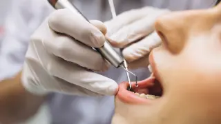 Los pacientes que sufren al mismo tiempo de periodontitis y enfermedades cardiovasculares pueden tener un mayor riesgo de complicaciones sistémicas, de modo que es esencial mantener una buena salud bucal y revisiones periódicas.