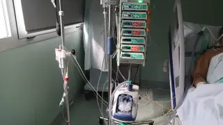 Uno de los equipos para la oxigenoterapia de alto flujo en el hospital Miguel Servet de Zaragoza.