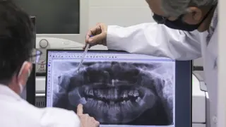 Los doctores Baena y Obón observan la 'foto' de una dentadura tomada con un ortopantomógrafo.