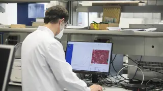 Gómez-Arrue, con los resultados de las PCR analizadas