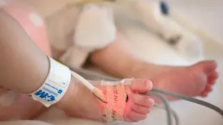 La bebé de dos meses Nairara recibe su corazón en un trasplante único en el mundo