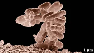 Micrografía electrónica de un cúmulo de bacterias E. coli ampliado cien mil veces. Cada cilindro redondeado es un individuo.