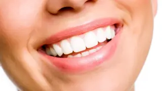 Los dentistas advierten del peligro de blanquearse los dientes con 'borradores mágicos', la nueva tendencia en TikTok