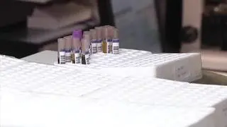 Cada vez más personas vacunadas acuden a los laboratorios para comprobar si ya han desarrollado anticuerpos