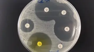 Cultivo bacteriano que resiste la acción de un antibiótico mientras los otros son eficaces contra él