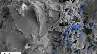 Imagen del CSIC de microplásticos en la microbiota intestinal