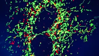 Células cancerígenas de pulmón incubadas con los compuestos metálicos desarrollados.