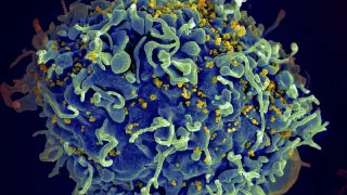 Célula T humana (en tono azul), atacada por el VIH.