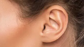 lobuloplastia-oreja-rasgada-1024x510