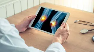 Doctor observando unos rayos X de piernas con dolor en las rodillas.