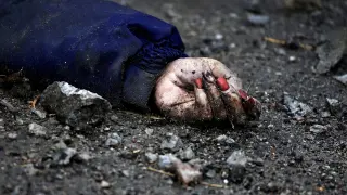 La mano de Iryna Filkina, una mujer que murió tras el ataque ruso en Bucha.