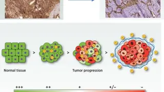 Demuestran el papel de unas proteínas para ayudar al sistema inmune a detectar el cáncer