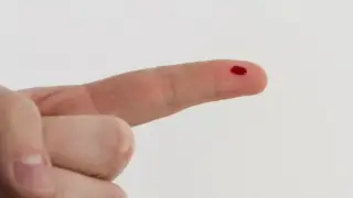 Un pinchazo en el dedo podría ser la alternativa a la analítica de sangre intravenosa