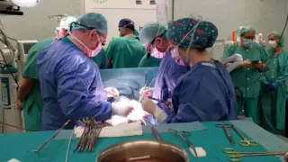 El Servet realiza el primer implante de un dispositivo de asistencia ventricular izquierda