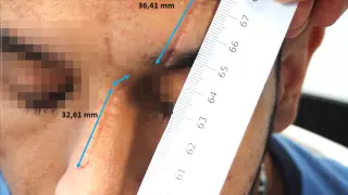 La víctima tuvo que recibir 17 puntos de sutura en el rostro.