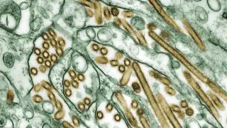 Virus de la gripe aviar A H5N1 (en dorado) cultivados en células MDCK (en verde). Imegen tomada con un microscopio electrónico de transmisión y coloreada.