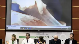 La consejera de Salud y Consumo de la Junta de Andalucía, Catalina García, acompañada por la directora de la Unidad de Cirugía Plástica y Grandes Quemados del Hospital Virgen del Rocío, Purificación Gacto, el director gerente del hospital, Manuel Molina,