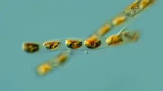 Encyonema, un tipo de diatomea