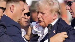 Spari contro Trump: il sangue sul viso di Donald Trump