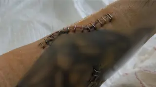 Así quedó el brazo de la víctima tras la agresión.