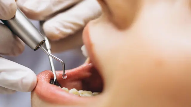 El 47 por ciento de los españoles tiene un poco, bastante o mucho miedo a acudir al dentista.