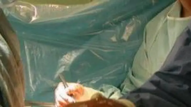 Trasplante hepático realizado en el Hospital Clínico de Zaragoza.