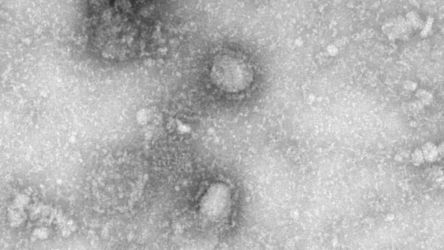 El coronavirus a vista de microscopio